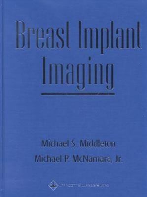Breast Implant Imaging [With CDROM]
