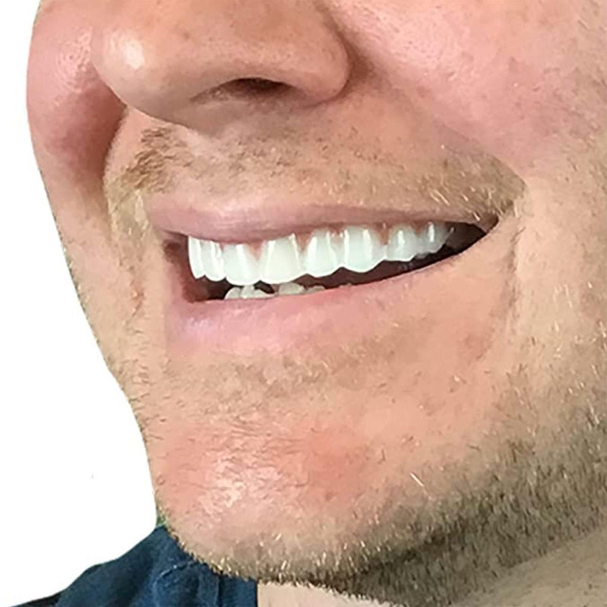50 Pz Colore Misto Dentale Ortodontico Usa E Getta Elastici Elastici Estrattore Posizionamento Gancio Elastomerico Legature Fascette Placer - Foto 12