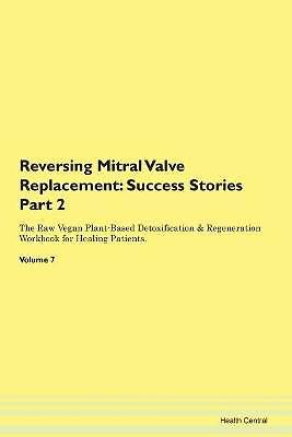 Reversing Mitral Valve Replacement, ,  Paperback