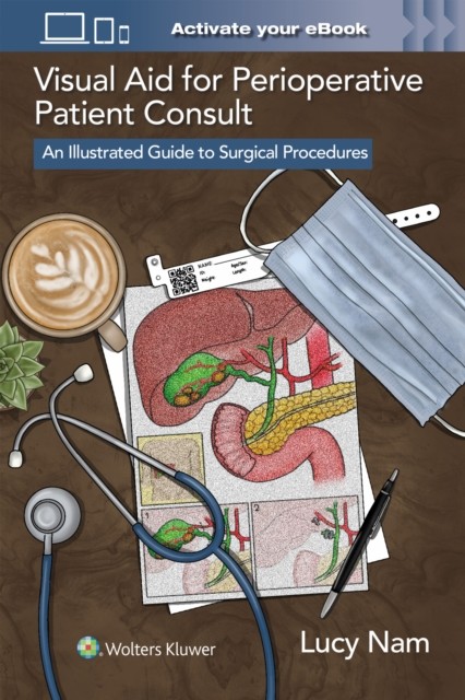 Visual Aid for Perioperative Patient Consult by Nam PAPERBACK 9781975235666
