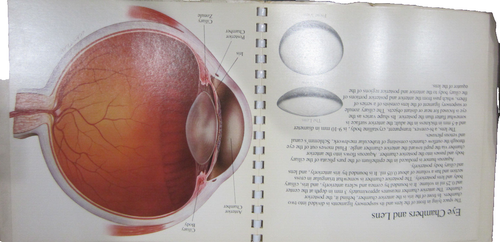 vintage Human Eye Anatomy clear clear plastic overlay .. - Foto 7 di 10