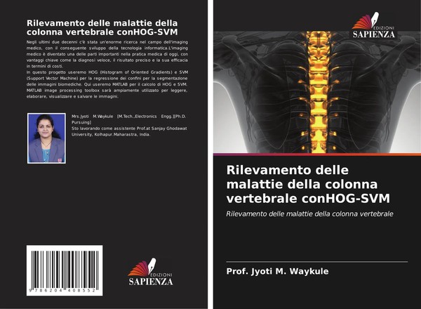 Rilevamento Delle Malattie Della Colonna Vertebrale Conhog-Svm Jyoti M. Waykule-image