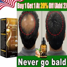 Biotin Hair Growth Spray Anti Hair Loss Fast Regrowth Scalp Treatment Serum