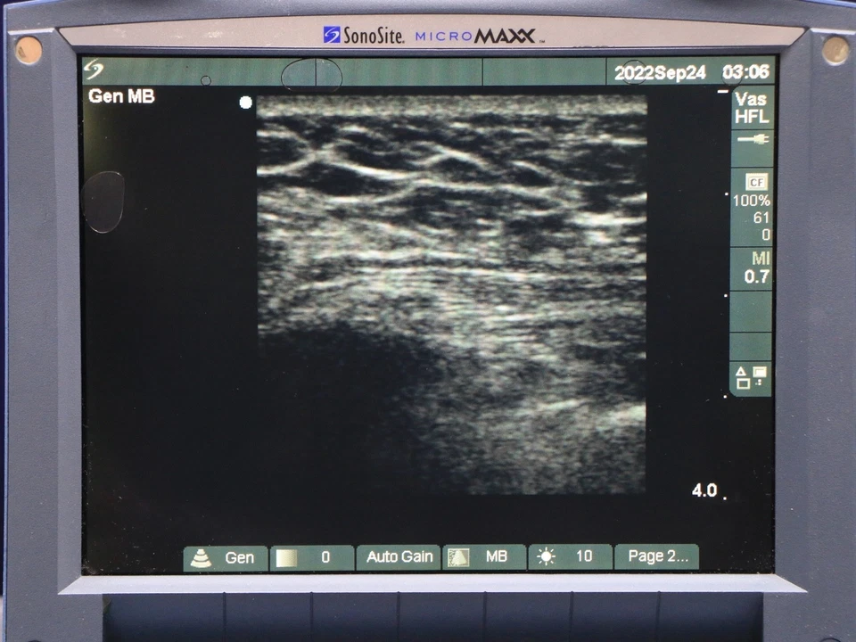 Sistema de ultrassom SonoSite MicroMaxx com sonda - Imagem 3 de 4