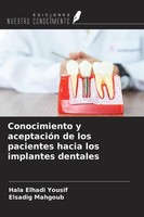 Conocimiento Y AceptacióN De Los Pacientes Hacia Los Implantes Dentales Elsadig