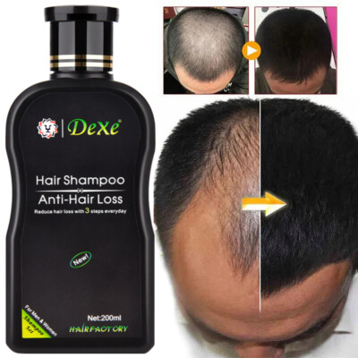 Dexe Anti Hair Loss Shampoo Ginger Serum Essence Hair Growth Regrowth Treatment