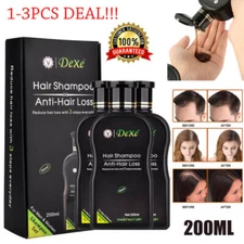 3/2Pcs Dexe Original Anti Hair Loss Shampoo Natural Herbal Hair Growth Treatment