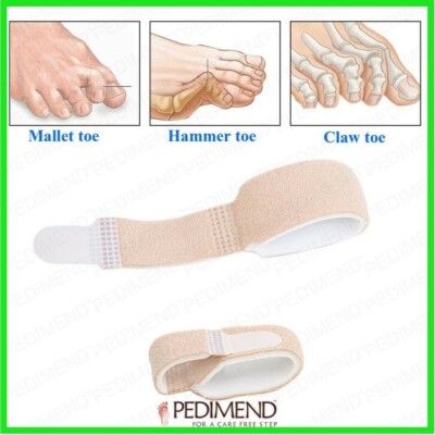PEDIMEND  gebrochen, gebogen, Klaue, Hammer Finger Zehen Befestigung verstellbare Schiene 1 STCK UK