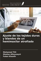 Ajuste De Los Tejidos Duros Y Blandos De Un Hemimaxilar Atrofiado Tlili (U. A.)