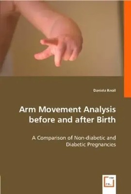 Daniela Knoll | Arm Movement Analysis Before and After Birth | Taschenbuch