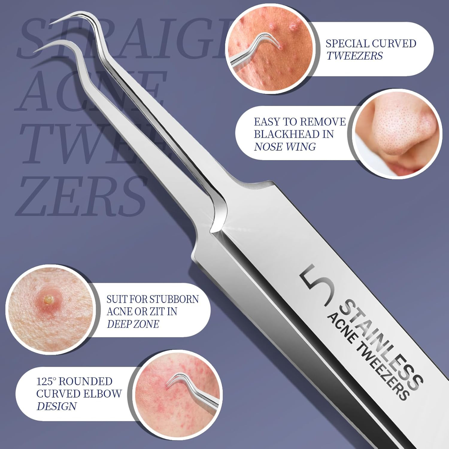 Blackhead Remover Kit - Pimple Popper & Ingrown Hair Tools