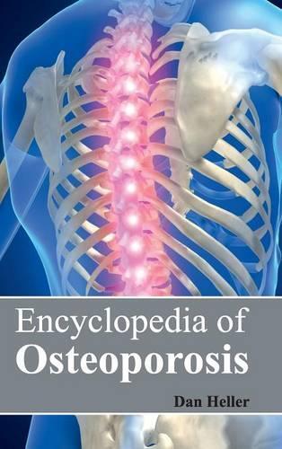 Thumbnail - Dan Heller Encyclopedia Of Osteoporosis (gebundene Ausgabe) (us