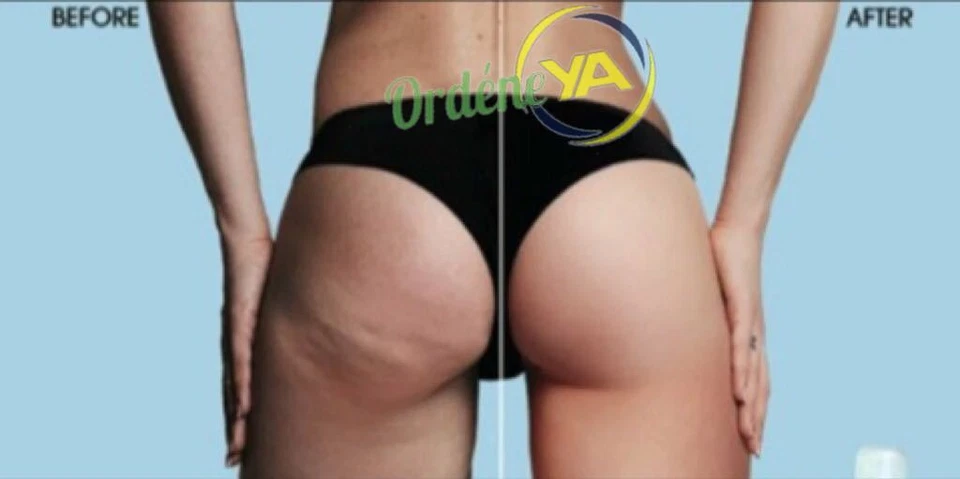 POWER SLIM PRO MASSAGE ANTI CELLULITE FIRMING CONCENTRATE CREAM SKIN CIRCULATION - Imagem 3 de 4