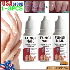 1-3PCS Fungi Nail Anti Fungal Liquid Formula Nail Repair Liquid Solution 15ml