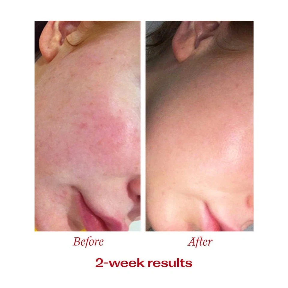 Trilogy Vitamin C Booster Treatment сыворотка 15 мл - Изображение 3 из 4