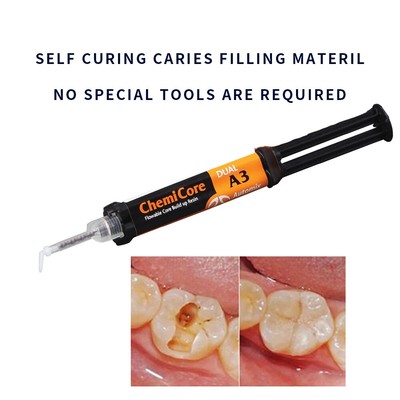 Caries Filling Material Tooth Repair Kit Restoration Permanent Filler Automix
