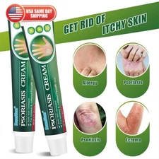 Skinmedix Care Cream Zlimplify Anti-itch Control Treatment Face and Body Eczema