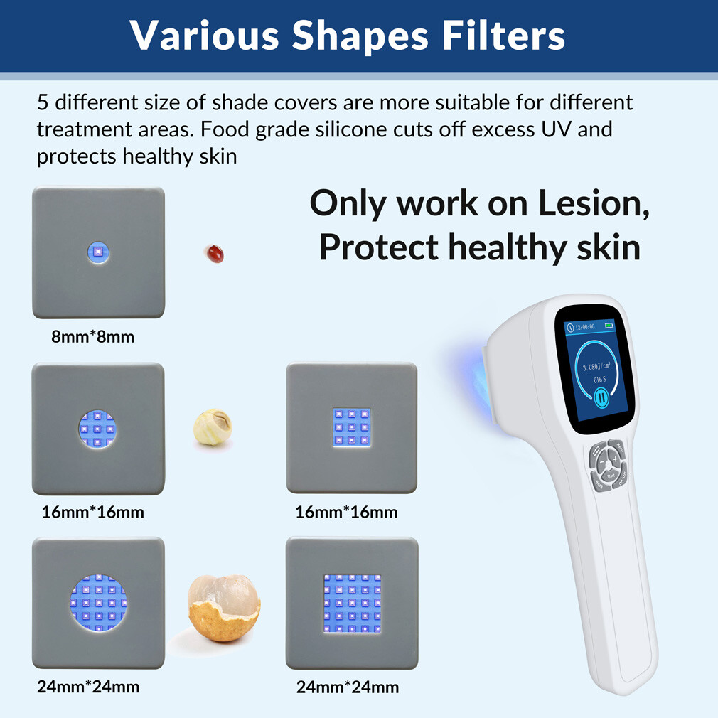 308nm Excimer Uvb Light Therapy Home Use Phototherapy Device for