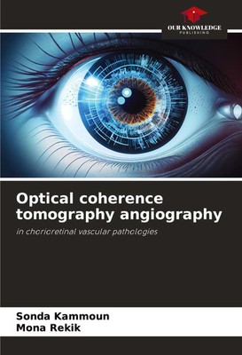 Sonda Kammoun (u. a.) | Optical coherence tomography angiography | Taschenbuch