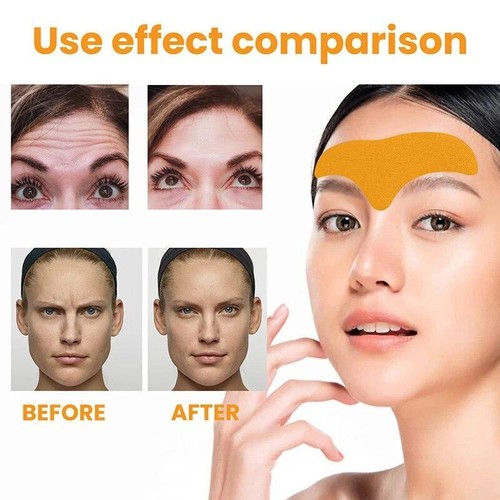 Forehead Wrinkle Patch Lifts Face, Tightens Skin, Fades and Smooths Lines Fast - Picture 22 of 24