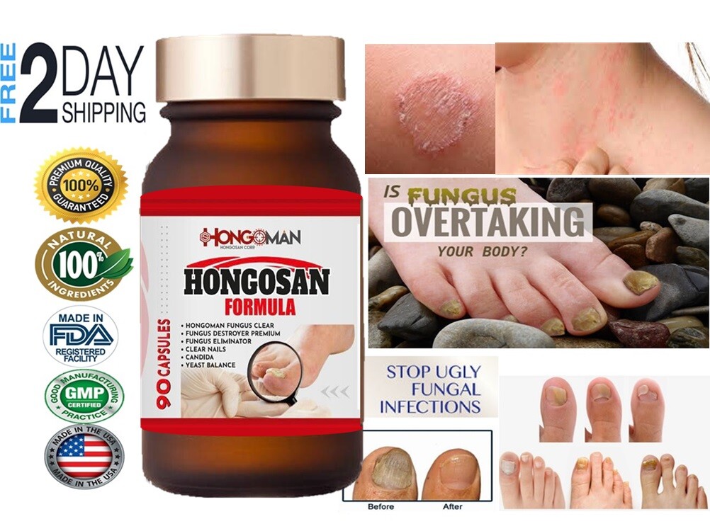HONGO SAN ORIGINALE ANTI FUNGO 180 CAPSULE E CREMA FORMULA HONGO ZANA supporto foto 5