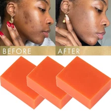 5PCS Original Kojic Acid Soap Bars Skin Whitening Turmeric Face and Body Soap