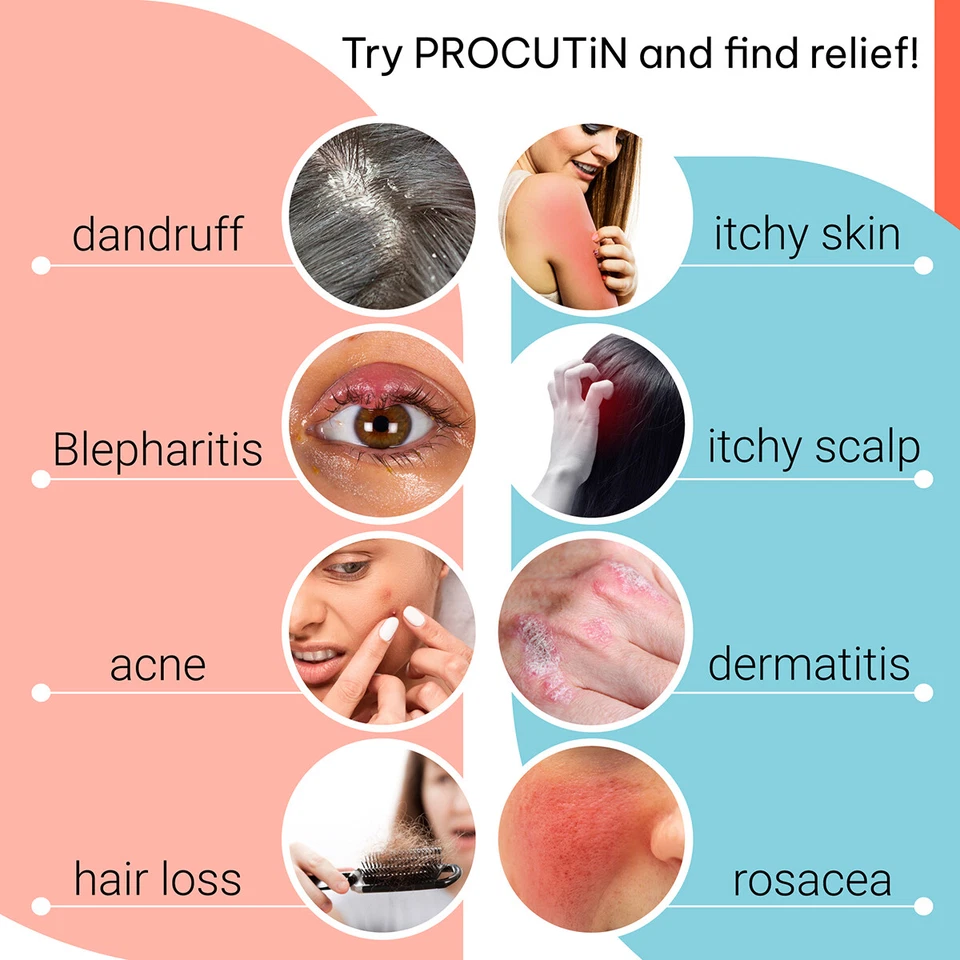 Tratamento de ácaros Demodex para acne rosácea dermatite blefarite coceira perda de cabelo - Imagem 3 de 4