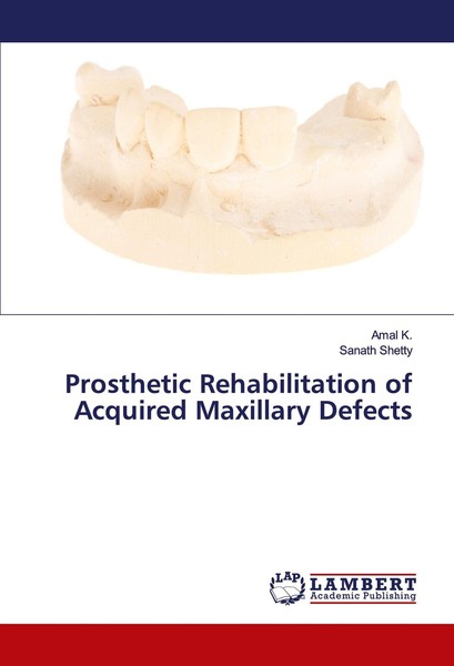 Prosthetic Rehabilitation Of Acquired Maxillary Defects Amal K.-image