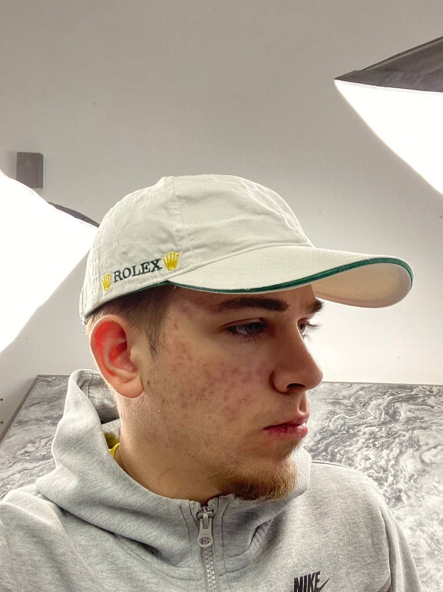 【希少】ROLEX ロレックス 刺繍ニット帽 PROFESSIONAL TEAM Rolex Baseball Cap Embroidered Logo Men One Size White | eBay