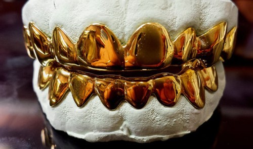 Grillz de plata esterlina 925 enchapado en oro amarillo de 18 K personalizado real hecho a mano - Imagen 1 de 5