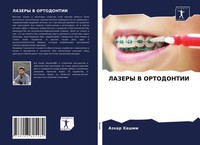 Azhar Hashmi | Lazery V Ortodontii | Taschenbuch | Russisch (2021)