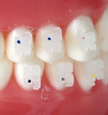 Orthodontic Clear Brackets MBT .018 Slot With Hooks on 3,4&5 Ceramic 10 sets 