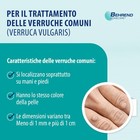 Foto 2 di 8