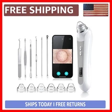 Smart Blackhead Remover Vacuum - 1080P HD Camera & LED for Ultimate Skin Clarity