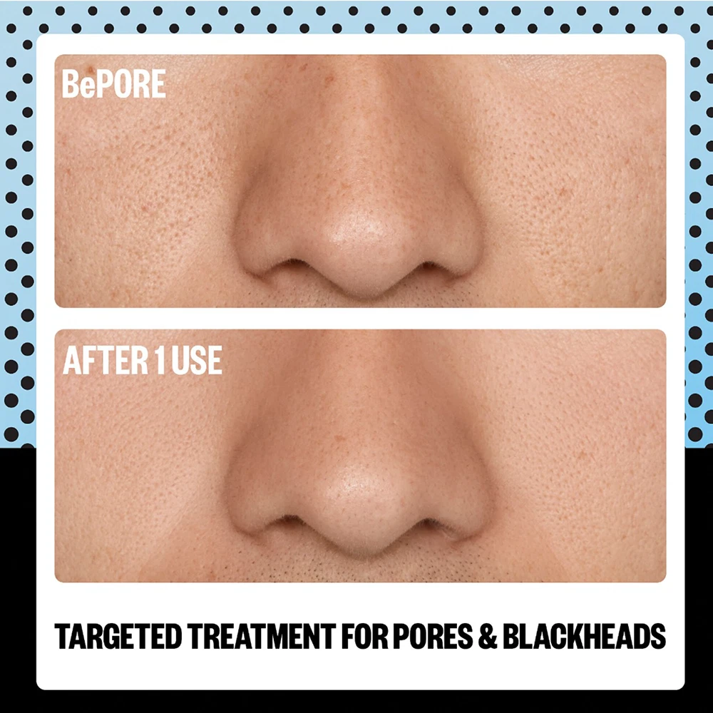 Peace Out AHA Pore Blackhead Exfoliator Multitasking Treatment