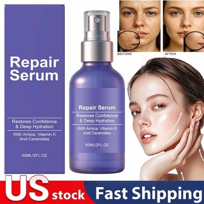 Reunoa Repair Serum Ceramide Serum With Ceramides, Vitamin K, And Arnica