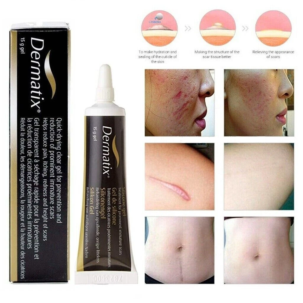 Dermatix on sale silicone gel