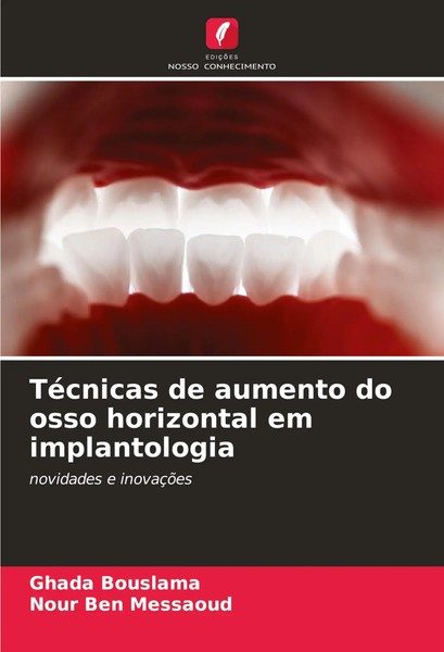 Ghada Bouslama (U. A.) | TéCnicas De Aumento Do Osso Horizontal Em Implantologia-image