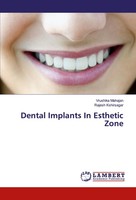 Vrushika Mahajan (U. A.) | Dental Implants In Esthetic Zone | Taschenbuch (2017)