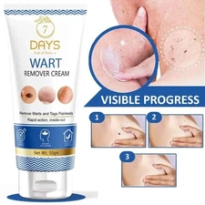 7 Days Genital Wart Removal Cream for Men & Women 50g