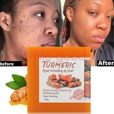 Tumeric Soap Turmeric Cream Whitening Ance blemish Corrector Dark Spots Brighter