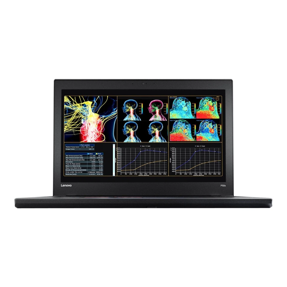 ESPECIAL EJECUTIVO ~ Portátil Lenovo ThinkPad FHD 15.6: ¡Intel i7! 32GB RAM - 1TB SSD Foto 3 de 4