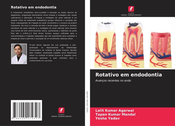 Lalit Kumar Agarwal (U. A.) | Rotativo Em Endodontia | Taschenbuch (2021)-image