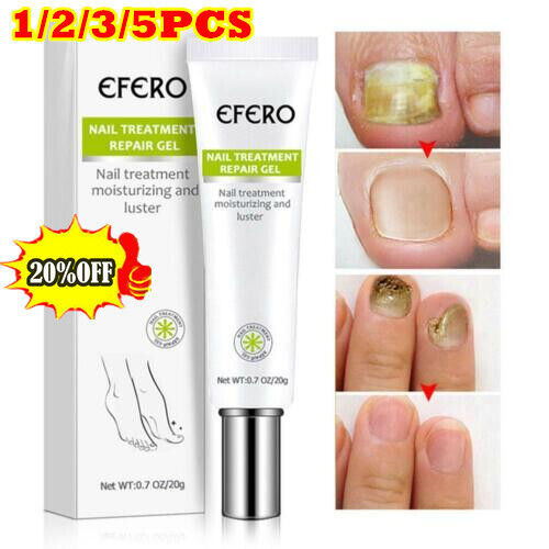 EFERO Nail Anti Fungal Infection Gel Treatment Hand Foot Cream Toenail RemoveNEW