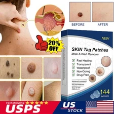 720pc Skin Tag Remover Patches Quick Effective Mole and Wart Pad Removal Sticker