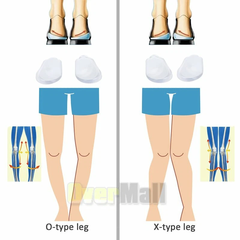 Plantillas de Supinación Inserciones Pronación Gel Corrector Silicona Zapato Medial Lateral Foto 3 de 4