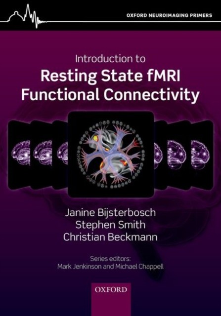 Introduction to Resting State fMRI Functional Connectivity by Janine Bijsterbos - Image 2