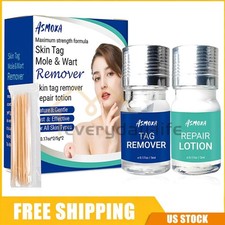 Skin Tag Remover and Repair Liquid Mole Corrector Wart Skin Tag Foot Corn Remove
