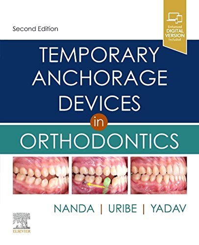 Temporary Anchorage Devices In Orthodontics Ravindra, Bds, Mds, Phd (Professor Emeritus Department Of Ortho Nanda - Image 5