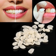 2 Bags Dental Veneers Shade A2 Upper Anterior Ultra-Thin Resin Teeth Mixed Size